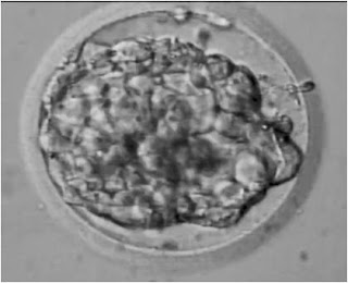 Everything you need to know about Laser Assisted Hatching