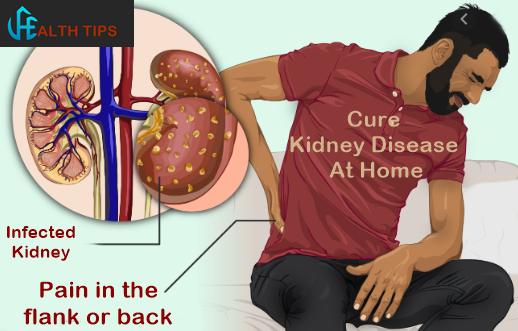 How To Cure Kidney Disease At Home