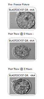 How can you know if your frozen embryos are alive after thawing and are ready to be transferred?