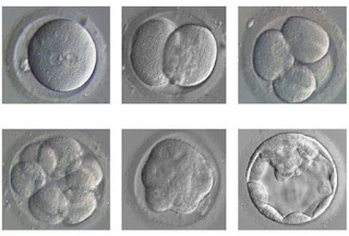 Why do bad IVF clinics refuse to give embryo photos routinely to all their patients ?